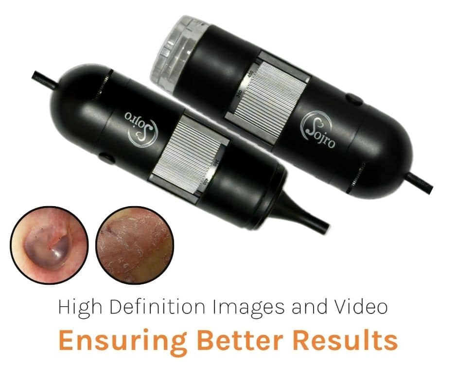 Sojro Otoscope & Dermascope with High Definition Images and Video