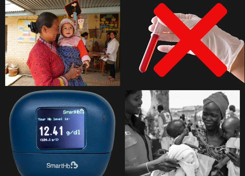 Why Non-Invasive Hemoglobin Monitoring is critical for reducing the burden of Anemia in the communities? A case for Tech4Life’s innovation ‘Smart-Hb’.