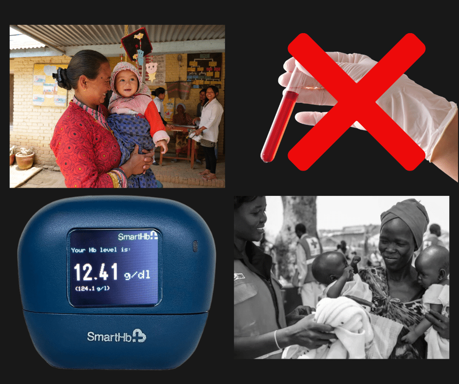 Why Non-Invasive Hemoglobin Monitoring is critical for reducing the burden of Anemia in the communities? A case for Tech4Life’s innovation ‘Smart-Hb’.